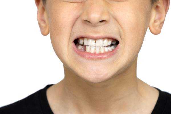 invisalign Armagh